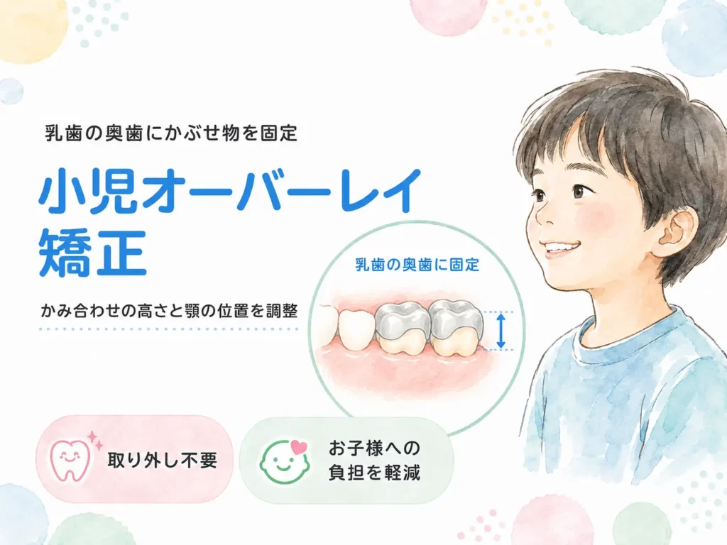 小児オーバーレイ矯正